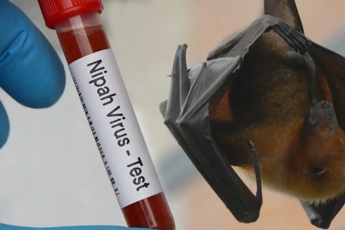 Ilustrasi Virus Nipah