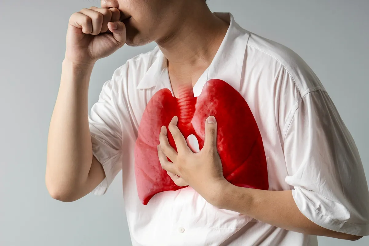 Gerakan Bersama Tekan 18.846 Kasus TBC Bandung